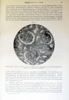 Neue deutsche Klinik. Handwörterbuch der praktischen Medizin. Bde. III, IV, VIII, IX, XV/5. Hrsg. v. Georg u. Felix Klemperer. Berlin-Wien, 1929-1938, Urban & Schwarzenberg. Kiadói aranyozott félbőr kötésben, illusztrációkkal, jó