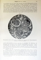 Neue deutsche Klinik. Handwörterbuch der praktischen Medizin. Bde. III, IV, VIII, IX, XV/5. Hrsg. v. Georg u. Felix Klemperer. Berlin-Wien, 1929-1938, Urban & Schwarzenberg. Kiadói aranyozott félbőr kötésben, illusztrációkkal, jó