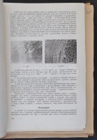 cca 1955-1979 Különlenyomatok gyűjteménye különféle orvosi szakfolyóiratokból (Kísérletes orvostudomány, Gyermekgyógyászat, Acta Chirurgica, Magyar Sebészet, Orvosi Hetilap...stb.), kb. 60-70 db., félvászon mappában egybekötve,